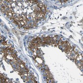 Anti-STIM1 antibody produced in rabbit Prestige Antibodies® Powered by Atlas Antibodies, affinity isolated antibody, buffered aqueous glycerol solution