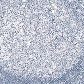 Monoclonal Anti-TYRP1 antibody produced in mouse Prestige Antibodies® Powered by Atlas Antibodies, clone CL4923, purified immunoglobulin, buffered aqueous glycerol solution