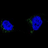 Monoclonal Anti-TYRP1 antibody produced in mouse Prestige Antibodies® Powered by Atlas Antibodies, clone CL4917, purified immunoglobulin, buffered aqueous glycerol solution