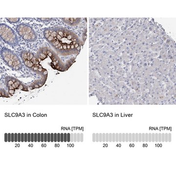 Anti-SLC9A3 antibody produced in rabbit Prestige Antibodies&#174; Powered by Atlas Antibodies, affinity isolated antibody, buffered aqueous glycerol solution