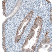 Monoclonal Anti-EPCAM antibody produced in mouse Prestige Antibodies® Powered by Atlas Antibodies, clone CL6313, purified immunoglobulin, buffered aqueous glycerol solution