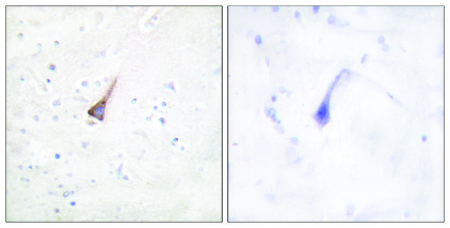 Anti-PTP1B antibody produced in rabbit affinity isolated antibody