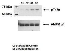 Anti-phospho-AMPK alpha-1 Antibody, (Thr479) from rabbit, purified by affinity chromatography