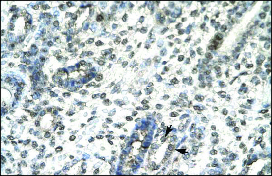 Anti-TBX21 antibody produced in rabbit affinity isolated antibody