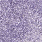 Anti-CTAG2 antibody produced in rabbit Prestige Antibodies® Powered by Atlas Antibodies, affinity isolated antibody, buffered aqueous glycerol solution
