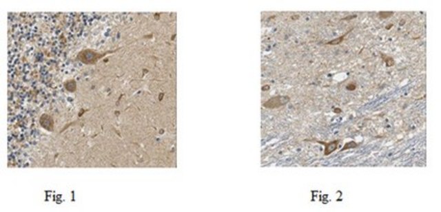 Anti-TMEM132A Antibody from rabbit, purified by affinity chromatography