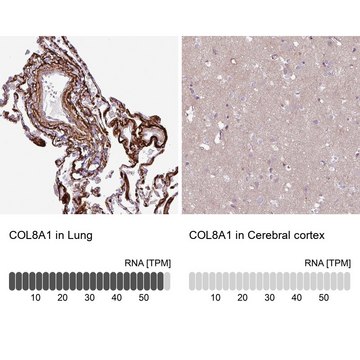 Anti-COL8A1 antibody produced in rabbit Prestige Antibodies&#174; Powered by Atlas Antibodies, affinity isolated antibody, buffered aqueous glycerol solution