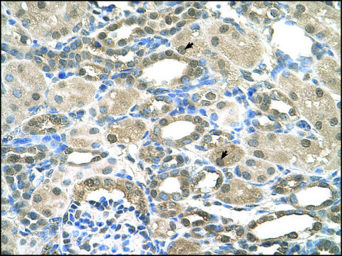 Anti-PSEN2 antibody produced in rabbit affinity isolated antibody