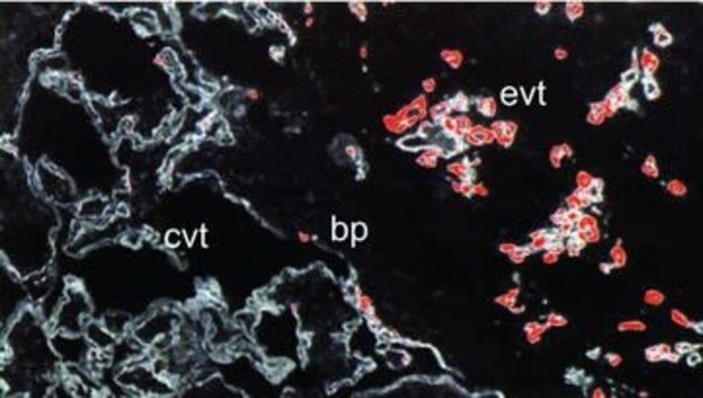 Monoclonal Anti-Cytokeratin Peptide 7 antibody produced in mouse clone LDS-68, ascites fluid