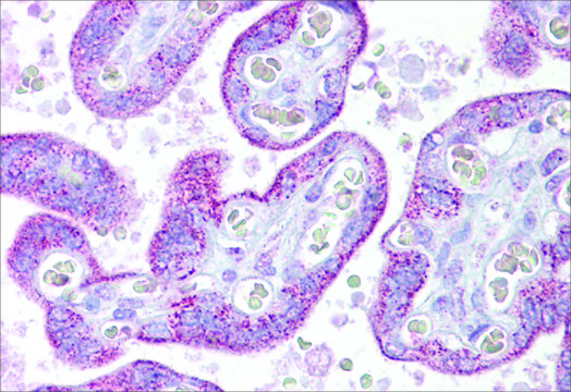 Anti-TRPC4 antibody produced in rabbit affinity isolated antibody