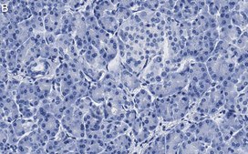 Anti-MICA Antibody, clone 4F8 ZooMAb® Rabbit Monoclonal recombinant, expressed in HEK 293 cells