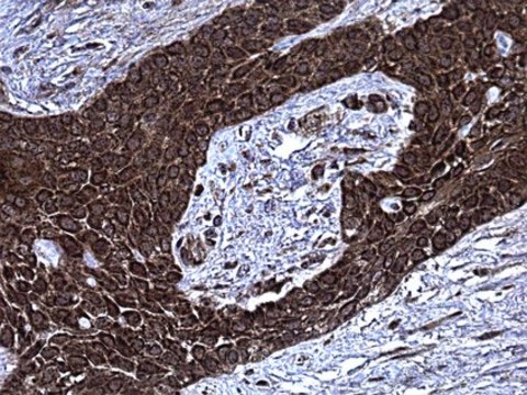 Anti-Pleiotrophin Antibody, clone 3B10 clone 3B10, from mouse