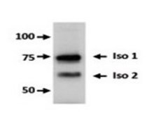 Anti-FBXO7 antibody produced in rabbit affinity isolated antibody