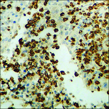 Anti-phospho-p62 Dok (pTyr398) antibody produced in rabbit affinity isolated antibody