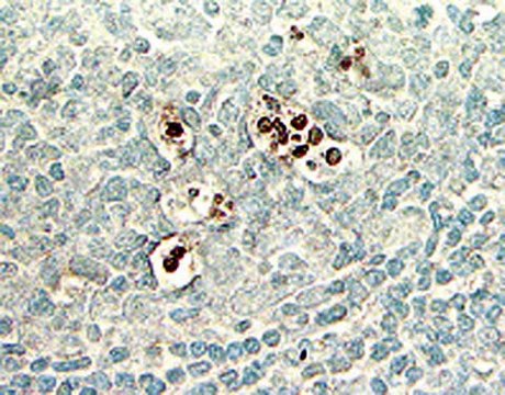 ApopTag Plus过氧化物酶原位凋亡检测试剂盒 The ApopTag Plus Peroxidase In Situ Apoptosis Detection Kit detects apoptotic cells by labeling &amp; detecting DNA strand breaks by the indirect TUNEL method.