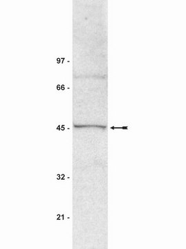 抗-SUV39H1抗体，克隆MG44 ascites fluid, clone MG44, Upstate&#174;