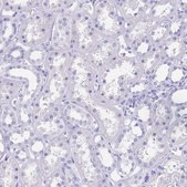 Anti-SLCO1B3 antibody produced in rabbit Prestige Antibodies® Powered by Atlas Antibodies, affinity isolated antibody, buffered aqueous glycerol solution