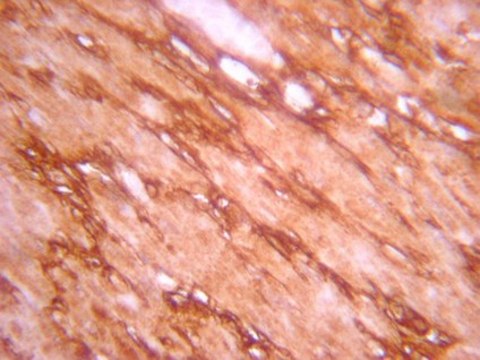 Anti-Notch1 Antibody, Intracellular serum, from rabbit