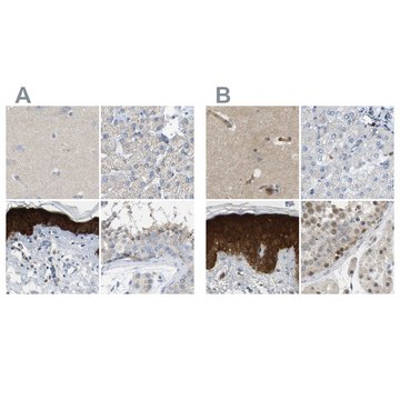 抗-SERPINB5 兔抗 Prestige Antibodies&#174; Powered by Atlas Antibodies, affinity isolated antibody, buffered aqueous glycerol solution