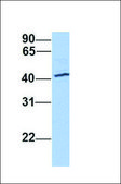 Anti-ACTR1B antibody produced in rabbit affinity isolated antibody