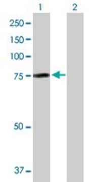 Anti-AHI1 antibody produced in rabbit purified immunoglobulin, buffered aqueous solution