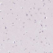 Anti-SLC5A2 antibody produced in rabbit Prestige Antibodies® Powered by Atlas Antibodies, affinity isolated antibody, buffered aqueous glycerol solution