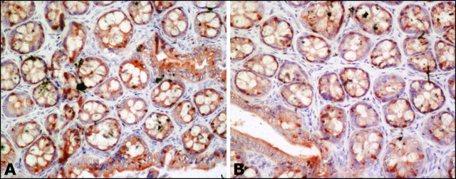 Anti-FUS (internal) antibody produced in rabbit ~1.0&#160;mg/mL, affinity isolated antibody