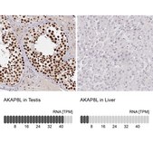 Anti-AKAP8L antibody produced in rabbit Prestige Antibodies® Powered by Atlas Antibodies, affinity isolated antibody, buffered aqueous glycerol solution