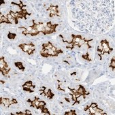 Anti-SLC22A13 antibody produced in rabbit Prestige Antibodies® Powered by Atlas Antibodies, affinity isolated antibody, buffered aqueous glycerol solution