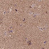 Anti-NAXE antibody produced in rabbit Prestige Antibodies® Powered by Atlas Antibodies, affinity isolated antibody, buffered aqueous glycerol solution