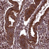 Anti-PLA2G4C antibody produced in rabbit Prestige Antibodies® Powered by Atlas Antibodies, affinity isolated antibody, buffered aqueous glycerol solution