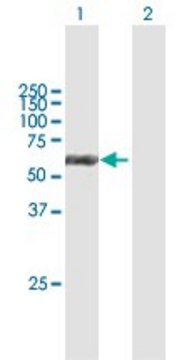 Anti-KRT6B antibody produced in mouse purified immunoglobulin, buffered aqueous solution