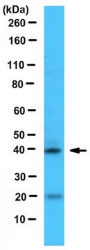 Anti-NeuroD1 Antibody serum, from rabbit