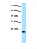 Anti-TNP1 antibody produced in rabbit affinity isolated antibody