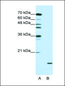 Anti-SNRPA1 antibody produced in rabbit IgG fraction of antiserum