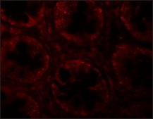 Anti-SLAMF1 antibody produced in rabbit affinity isolated antibody
