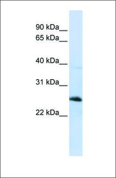 Anti-RTN1 (ab1) antibody produced in rabbit affinity isolated antibody