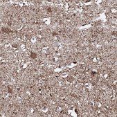 Anti-AMER2 antibody produced in rabbit Prestige Antibodies® Powered by Atlas Antibodies, affinity isolated antibody, buffered aqueous glycerol solution