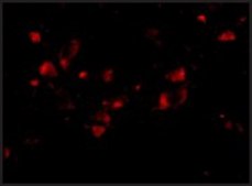 Anti-JPH4 (ab1) antibody produced in rabbit affinity isolated antibody, buffered aqueous solution