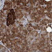 Anti-USP25 antibody produced in rabbit Prestige Antibodies® Powered by Atlas Antibodies, affinity isolated antibody, buffered aqueous glycerol solution
