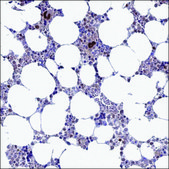 Anti-CERS6 antibody produced in rabbit Prestige Antibodies® Powered by Atlas Antibodies, affinity isolated antibody, buffered aqueous glycerol solution