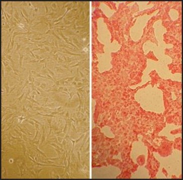 Rat Pulmonary Artery Smooth Muscle Cells: RPASMC, adult