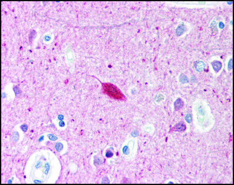 Anti-HARP antibody produced in rabbit affinity isolated antibody, buffered aqueous solution