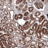 Monoclonal Anti-LAMP1 antibody produced in mouse Prestige Antibodies® Powered by Atlas Antibodies, clone CL4489, purified immunoglobulin