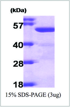 ALDH2 human recombinant, expressed in E. coli, &#8805;90% (SDS-PAGE)