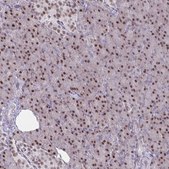 Anti-PRMT6 antibody produced in rabbit Prestige Antibodies® Powered by Atlas Antibodies, affinity isolated antibody, buffered aqueous glycerol solution