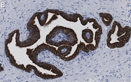Anti-Cytokeratin-8 Antibody, clone 2D17 ZooMAb® Rabbit Monoclonal recombinant, expressed in HEK 293 cells