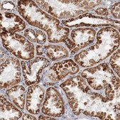Anti-NDUFS4 antibody produced in rabbit Prestige Antibodies® Powered by Atlas Antibodies, affinity isolated antibody, buffered aqueous glycerol solution