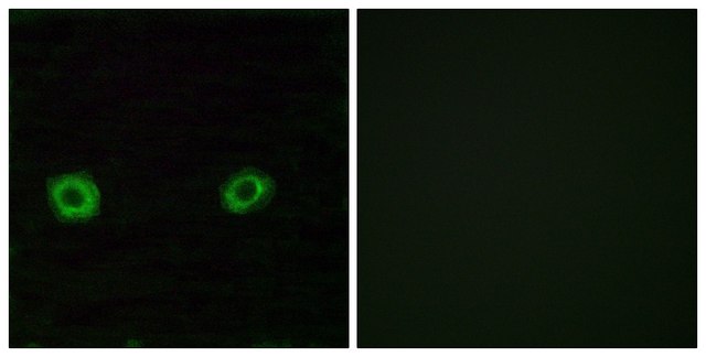 Anti-OR2D3 antibody produced in rabbit affinity isolated antibody