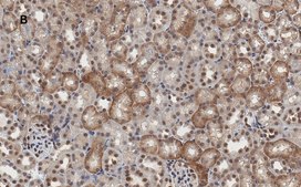 Anti-MLKL Antibody, clone 3F13, ZooMAb® Rabbit Monoclonal recombinant, expressed in HEK 293 cells